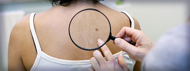 Δωρεάν δερματικός έλεγχος από τον Δήμο Αγίου Δημητρίου