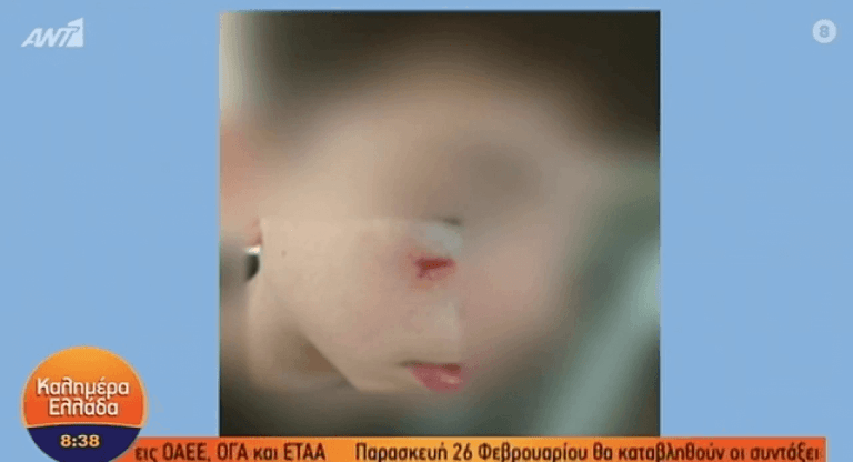 Ακόμα ένα περιστατικό βίας από ανήλικους: 13χρονος κατήγγειλε συμμαθητή του στην Ηλιούπολη
