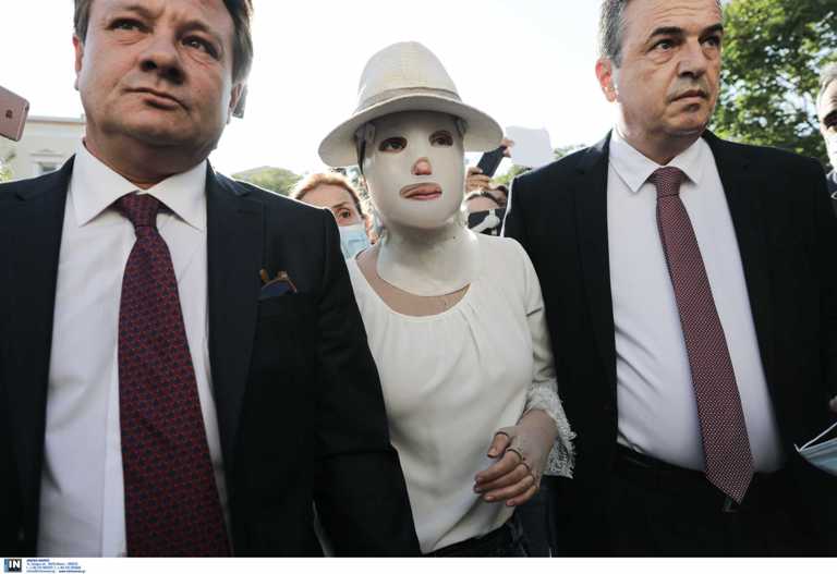 Επίθεση με βιτριόλι: Πότε η Ιωάννα θα βγάλει τη μάσκα αποκατάστασης