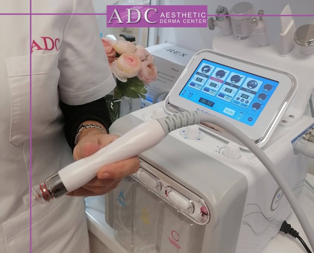 Υδροδερμοαπόξεση στο Κέντρο Αισθητικής Aesthetic Derma Center