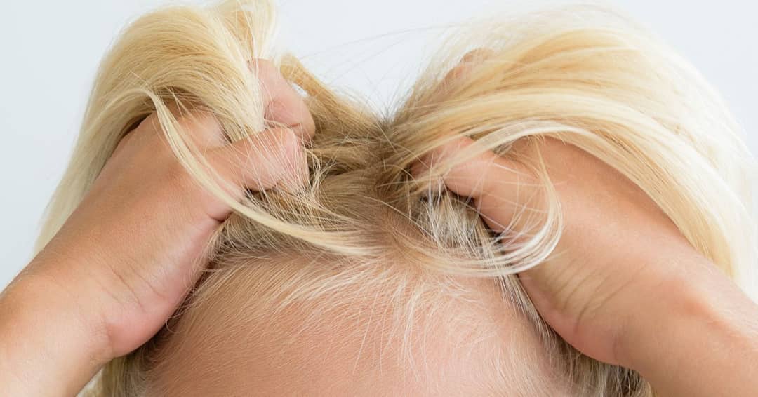 Lice Busters: Aαπαλλαχθείτε οριστικά από ψείρες και κόνιδες