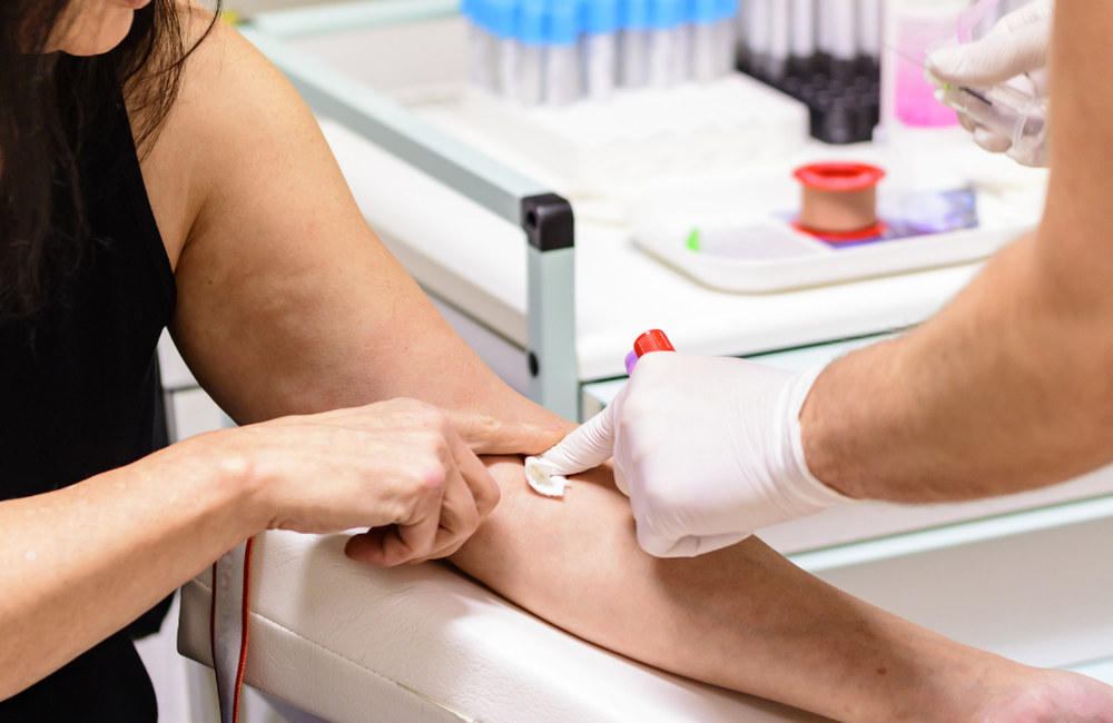 Αιματολογικές Εξετάσεις: Προετοιμασία, διαδικασία και Tips